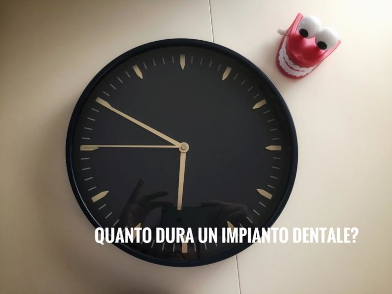 quanto dura impianto dentale